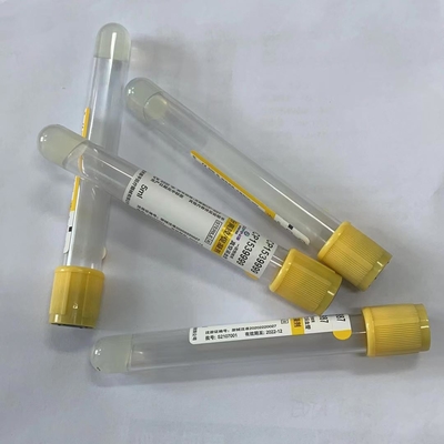 5ml medische Beschikbare Vacuüm de Buis Gele Hoofddekking van de Bloedinzameling