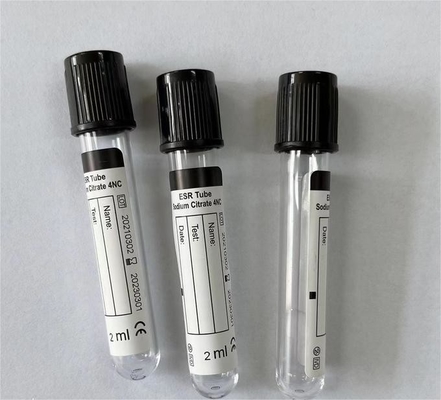 ESR van de bloedinzameling van het het Natriumcitraat van Buisce ISO13485 3,8% het HUISDIERENglas
