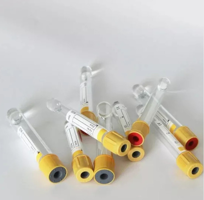 3 ml tot 10 ml gel- en stollingsactivatorbuis voor bloedsuikerscholesterol- en urinezuuronderzoeken