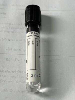 1.6 ml ESR vacuümbuis met 3,8% natriumcitraat voor bezinkingssnelheid